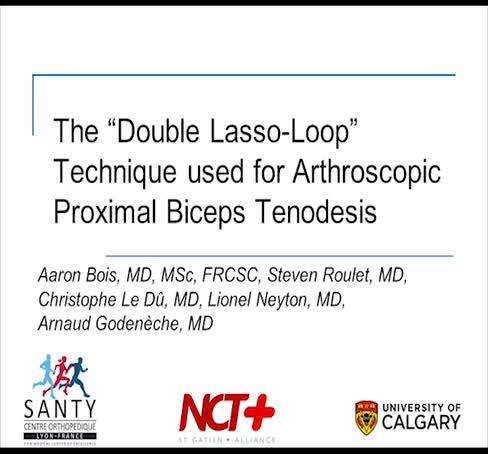 Double Lasso-Loop Biceps Tenodesis (Dr Godeneche)
