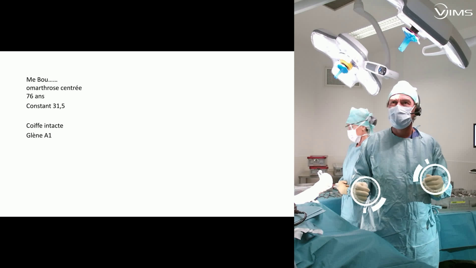 EMI Arthroplastie en pyrocarbone (Dr Gravier)