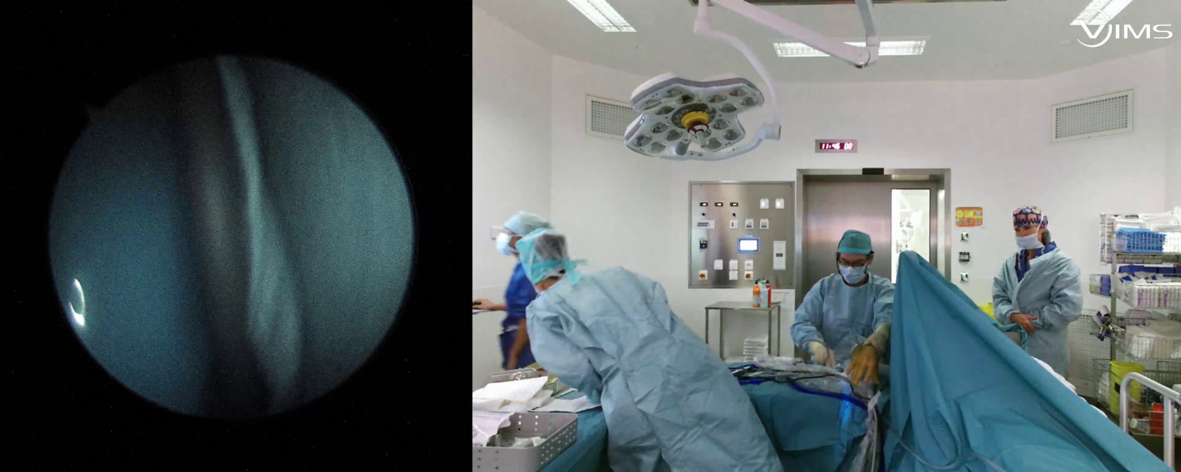 Epicondylite (Dr Gravier)