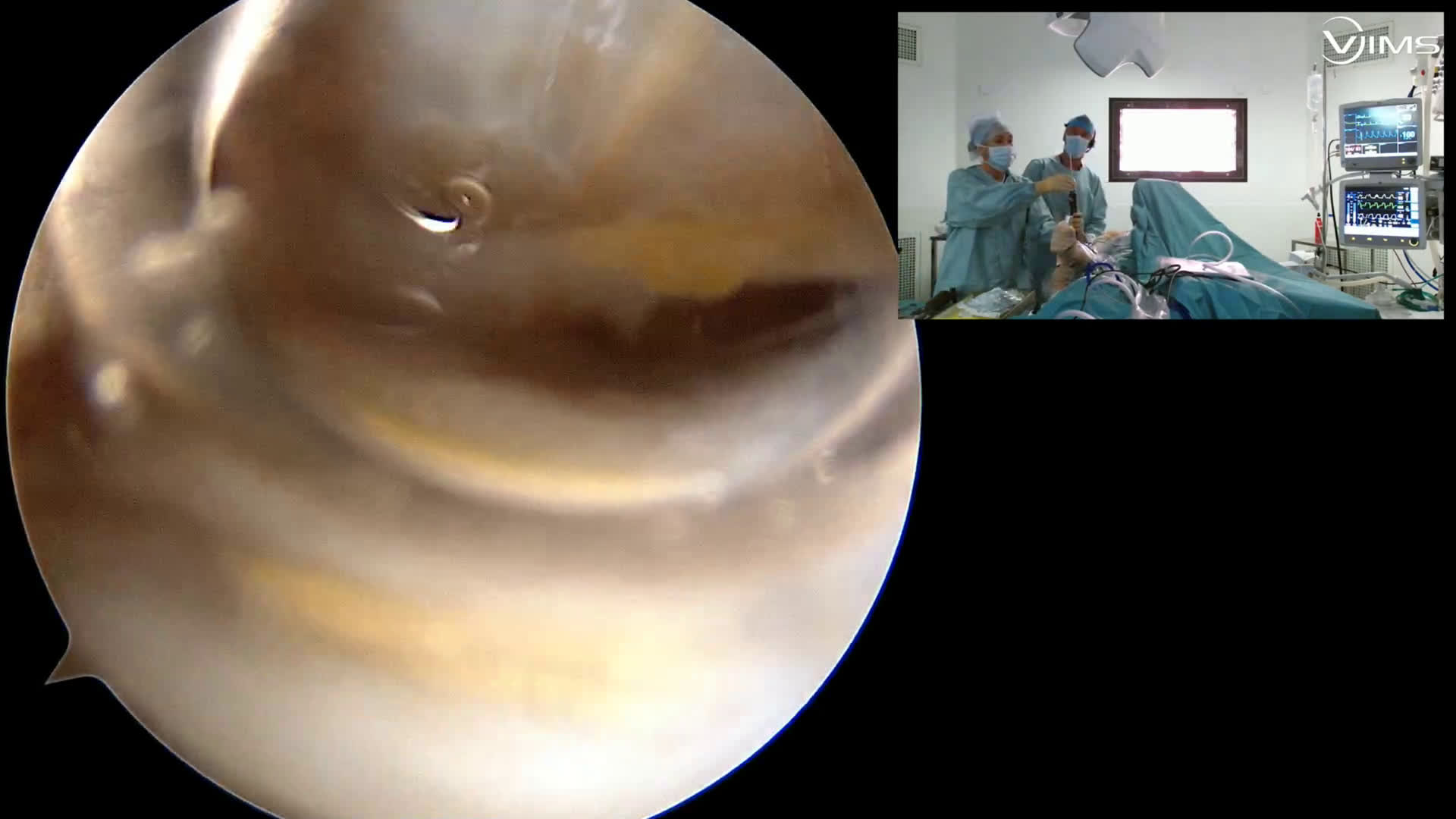 DAC (Dr Gravier)