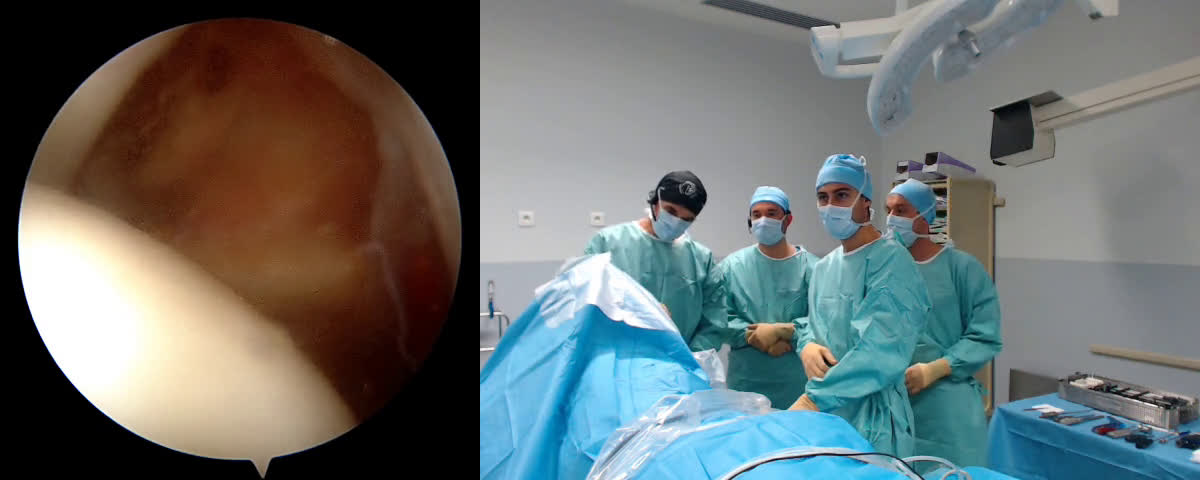 @Latarjet procedure with Dr Marcello Stamilla (Dr. Kany)