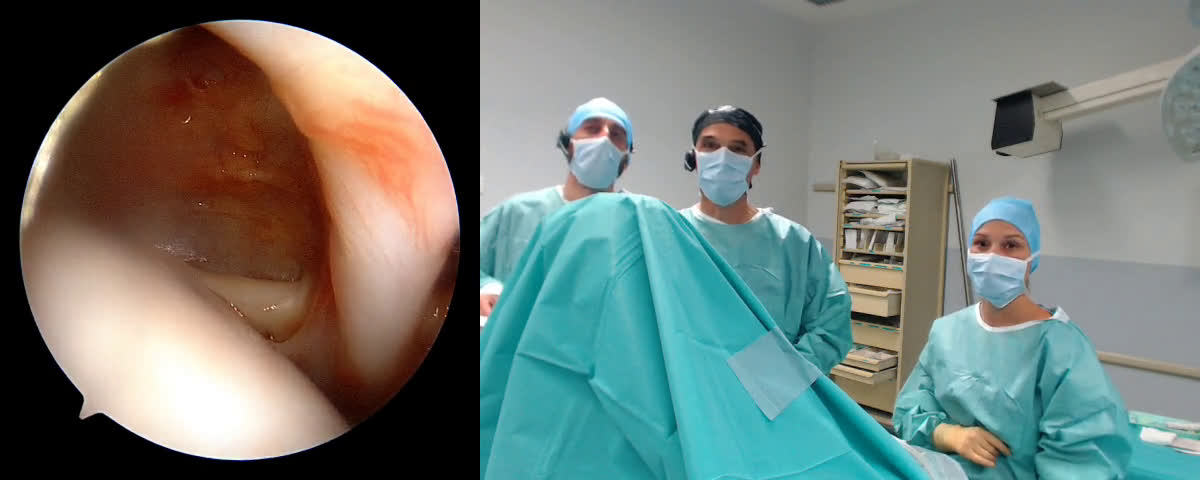 @Latarjet classic procedure with Dr. Dan Scorpie & Dr. Marie Marten (Dr. Kany)
