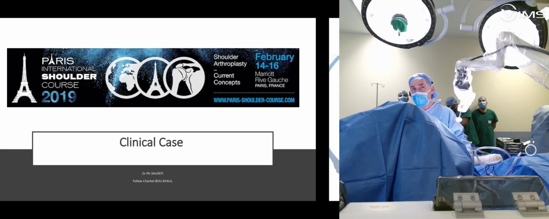 Shoulder Arthroplasty (Jan. 30) (Dr. Valenti)