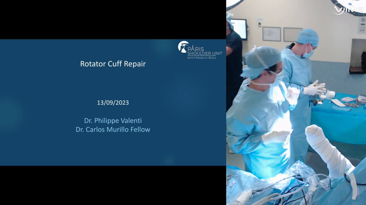 Rotator Cuff Repair (Dr. Valenti)