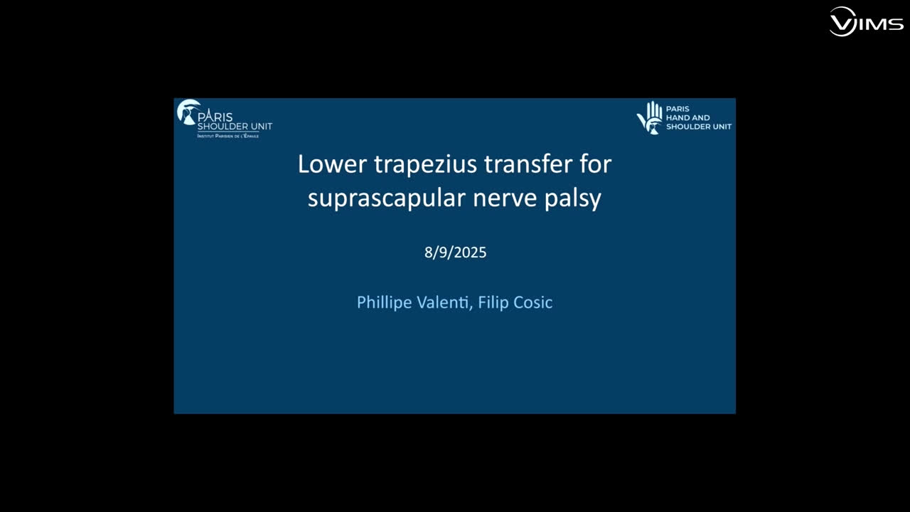 Lower trapezius transfer for suprascapular nerve plasy (Dr. Valenti)