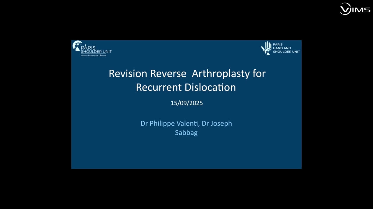 Revision reverse arthroplasty for recurrent dislocation (Dr. Valenti)