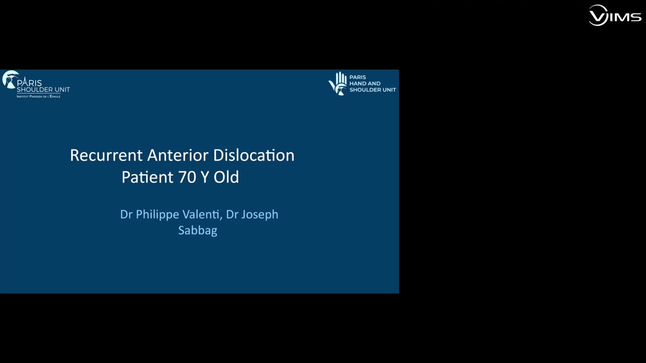 Recurrent anterior dislocation (Dr. Valenti)