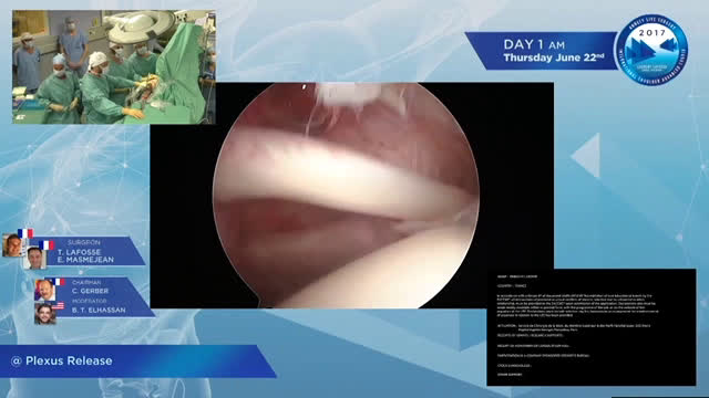 All-Endoscopic Resection of an Infraclavicular Brachial Plexus Schwannoma: Surgical Technique (Dr. Lafosse)
